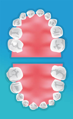 Dentiste enfants Bordeaux