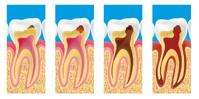 Dentiste Bordeaux (peyronnet)